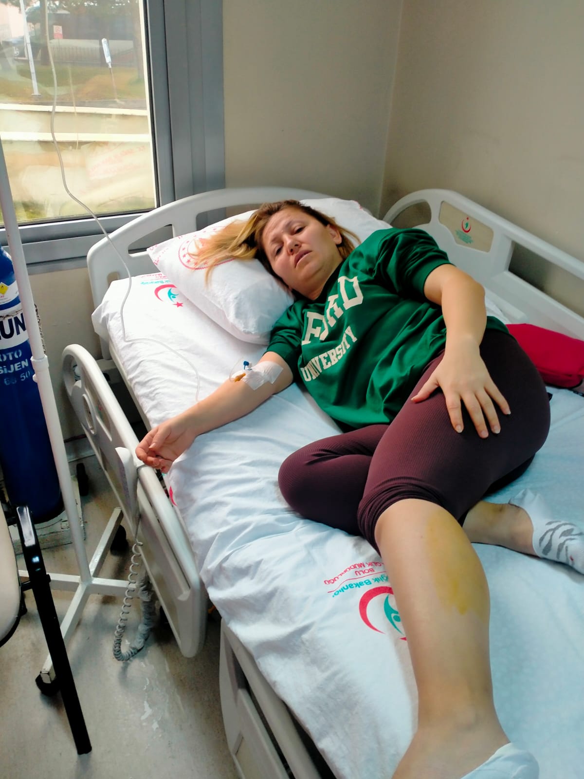 Bolu’da köpeklerin saldırısında bacağından yaralanan kadın tedavi edildi