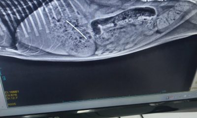 Zonguldak’ta yavru kedinin yuttuğu dikiş iğnesi endoskopiyle çıkarıldı