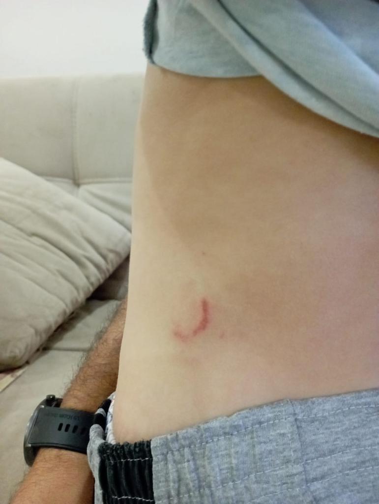 Karabük’te sokak köpeklerinin saldırısına uğrayan çocuk yaralandı